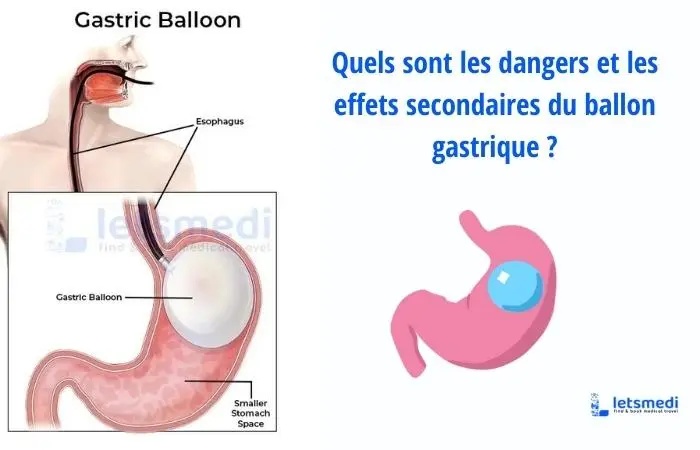 ballon gastrique danger
